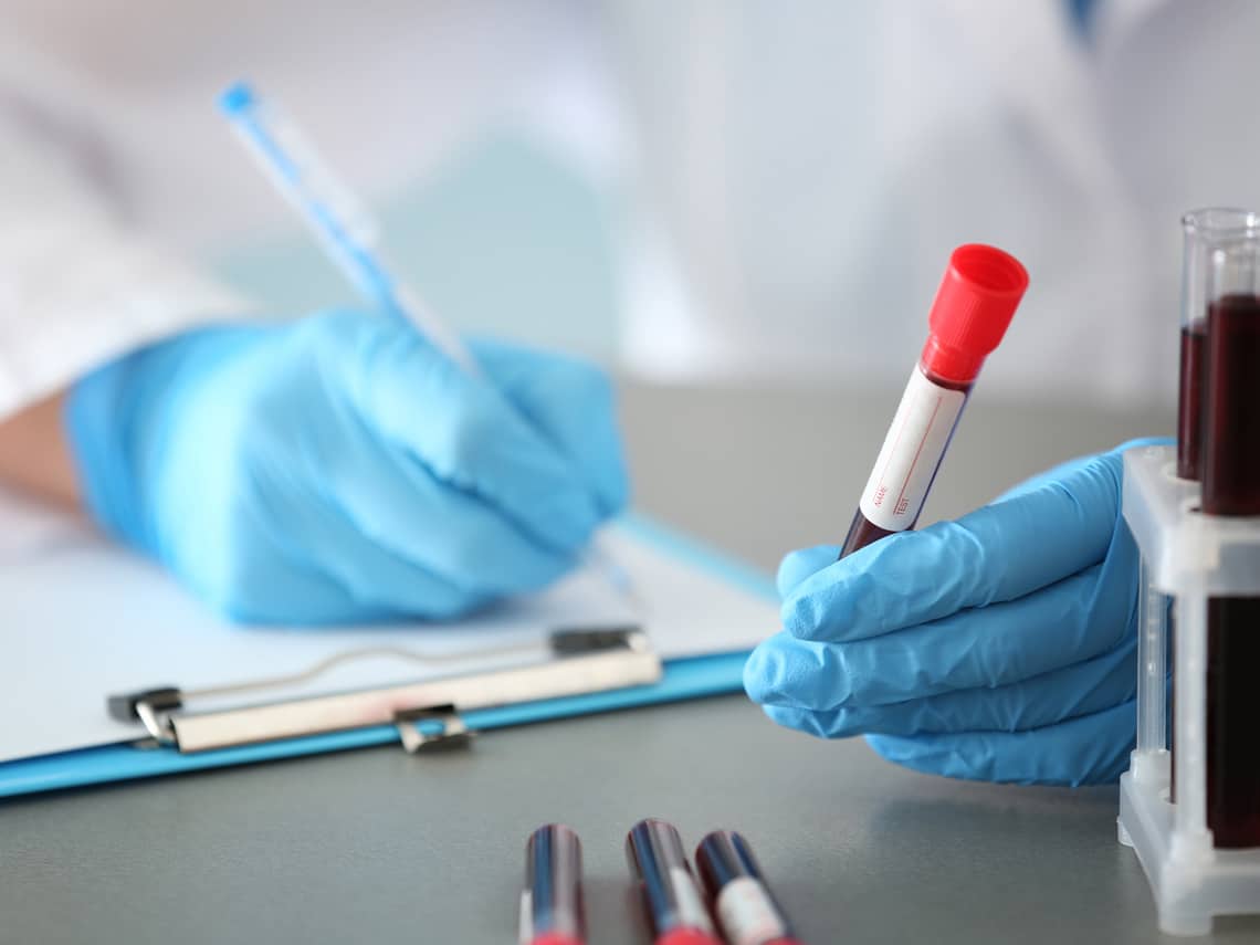 lab tech doing psa tests